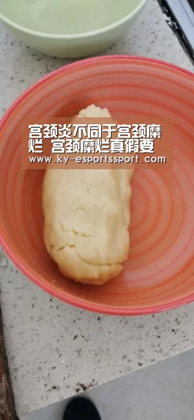 宫颈炎不同于宫颈糜烂 宫颈糜烂真假要分辨:开云电竞官网(图2) 开云体育下载